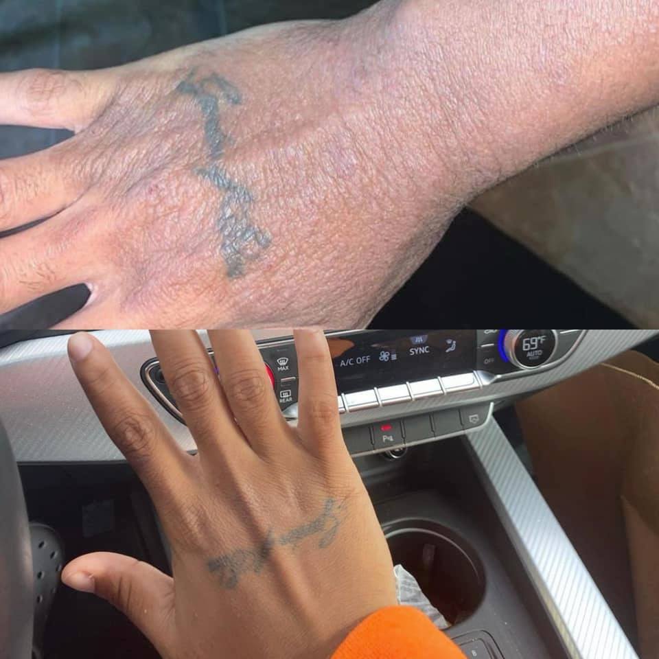 Eczema Wash
